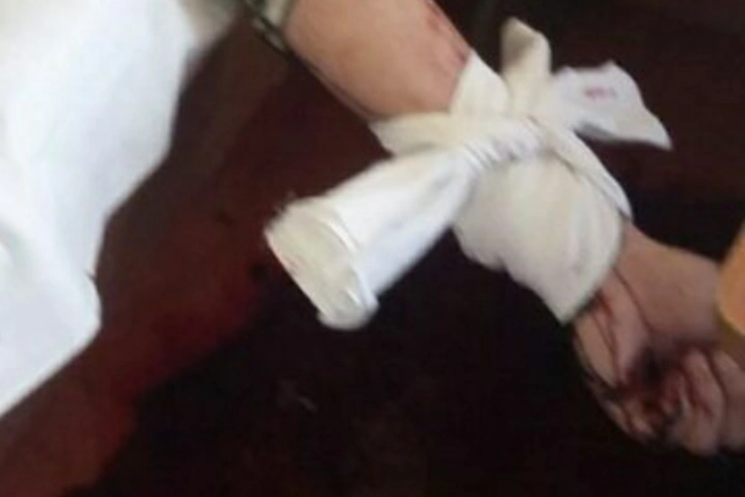 Qubada müəllim hoteldə məktub yazaraq damarlarını kəsib - FOTO