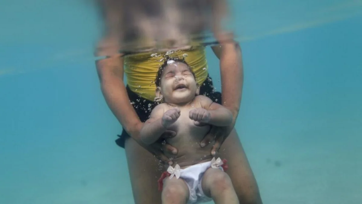 Evidence mounts linking Zika virus to birth defects