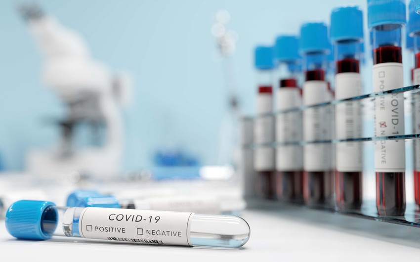 В Сингапуре испытывают тест, определяющий заражение COVID-19 по дыханию