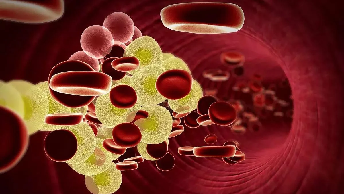 COVID-19 qanda yağların səviyyəsini artıra bilər