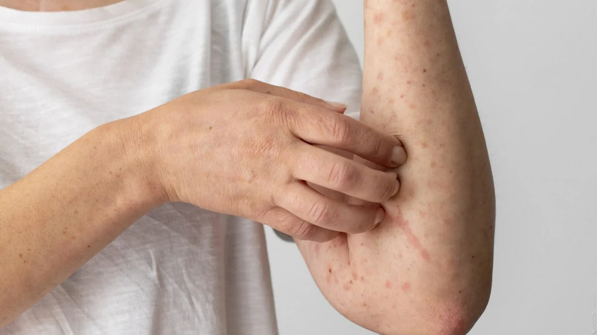 Monqolustanda bütün uşaqlar peyvənd olunacaqlar