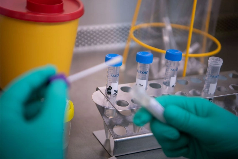 Azərbaycanda daha 191 nəfər koronavirusa yoluxub, 125 nəfər sağalıb