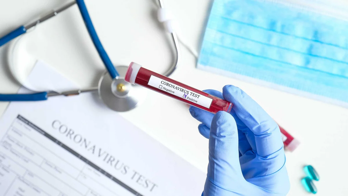 Baş nazir: “Gürcüstanda koronavirus epidemiyası yayılır”
