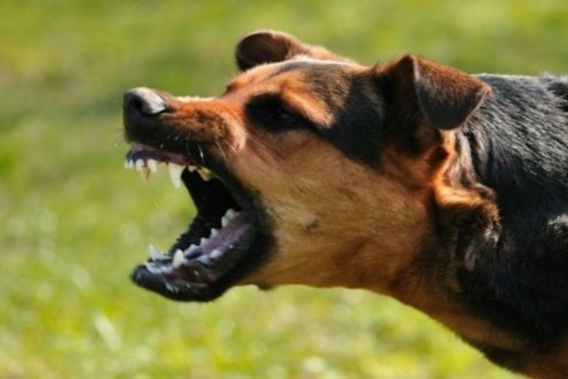 İt qadını dişləyərək bu hala saldı - FOTO