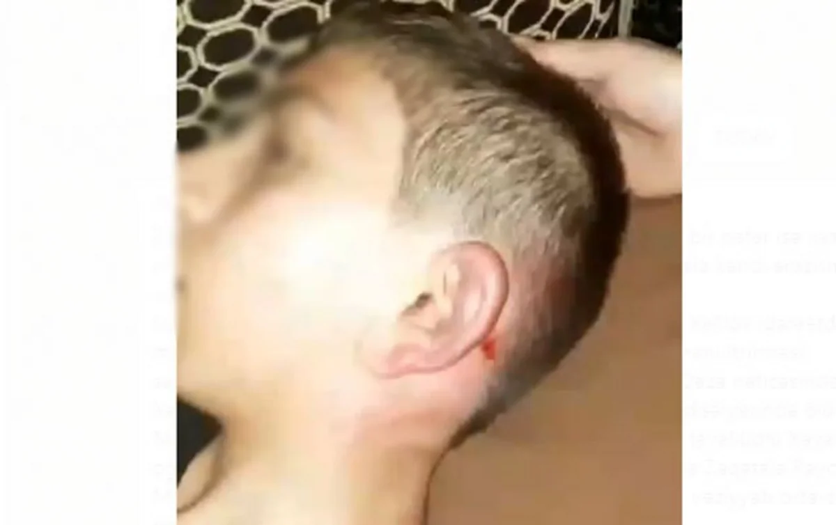 Gəncədə oğlunu döyən ata saxlanılıb, cinayət işi başlanılıb