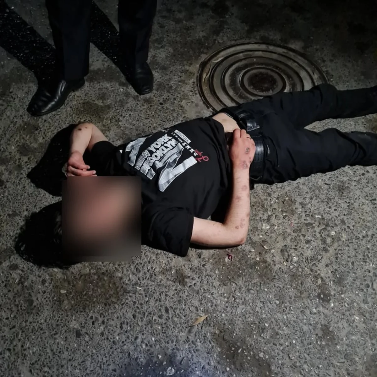 Patı qəbul edən gənc küçədə komaya düşdü - FOTO - YENİLƏNİB