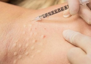 В Кыргызстане 18 человек отравились после инъекций ботокса