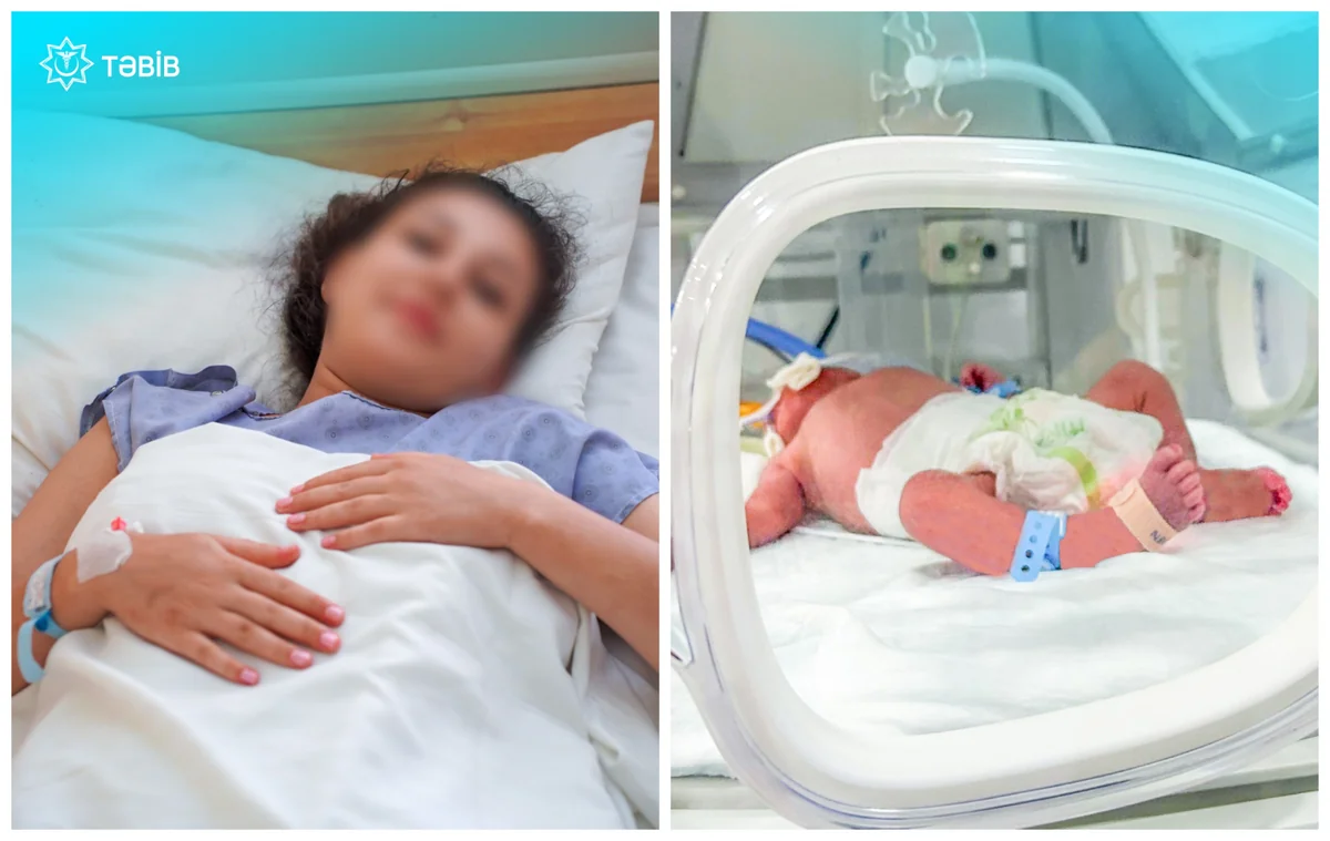 TƏBİB: Metroda doğulan körpə süni tənəffüs aparatına qoşulub