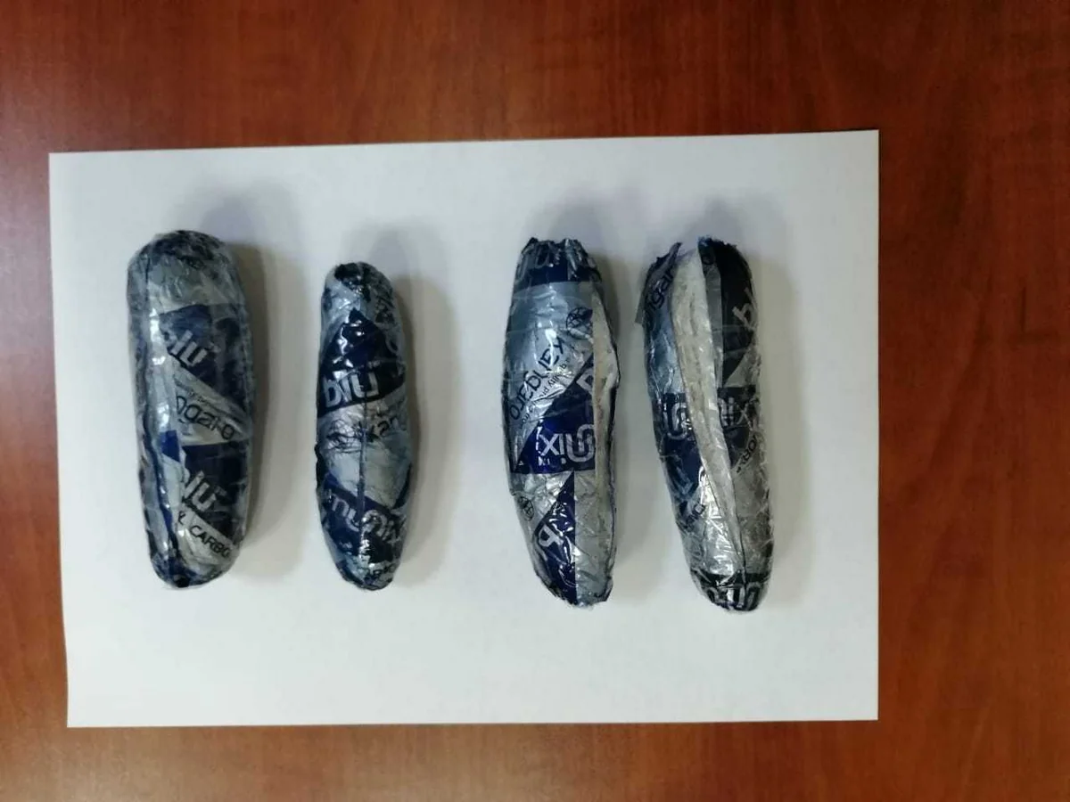 Azərbaycana gələn İran vətəndaşlarının daxili orqanlarında psixotrop maddə aşkarlanıb