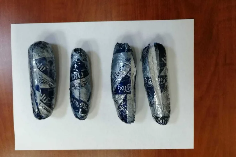 Azərbaycana gələn İran vətəndaşlarının daxili orqanlarında psixotrop maddə aşkarlanıb