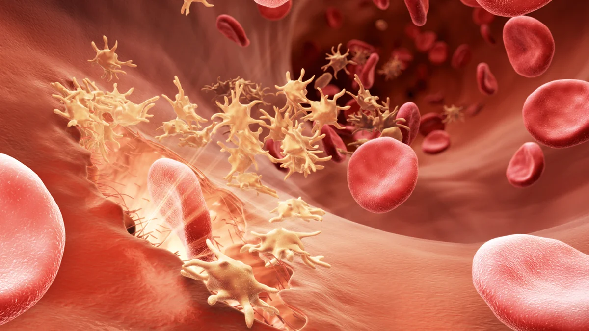 Azərbaycanda hemofiliya xəstələrinin sayı açıqlanıb