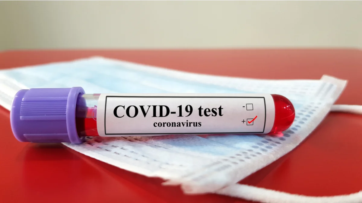 Azerbaijan confirms two new COVID-19 cases