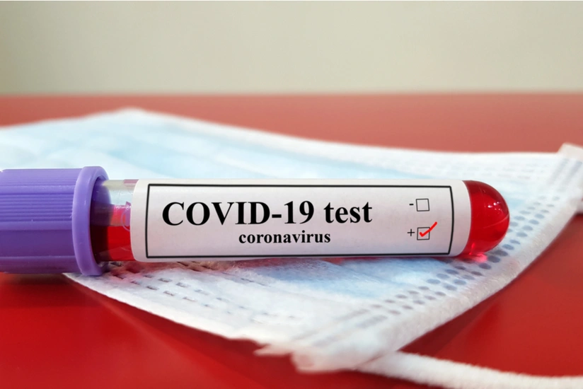 Azerbaijan confirms two new COVID-19 cases