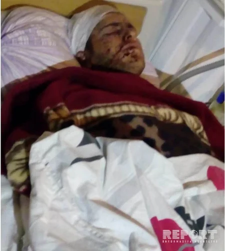 Bərdədə Amminal partlayıcı vasitəsi partlayıb, yaralananlar var - FOTO - YENİLƏNİB