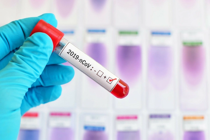 Azerbaijan confirms 2 new COVID-19 cases