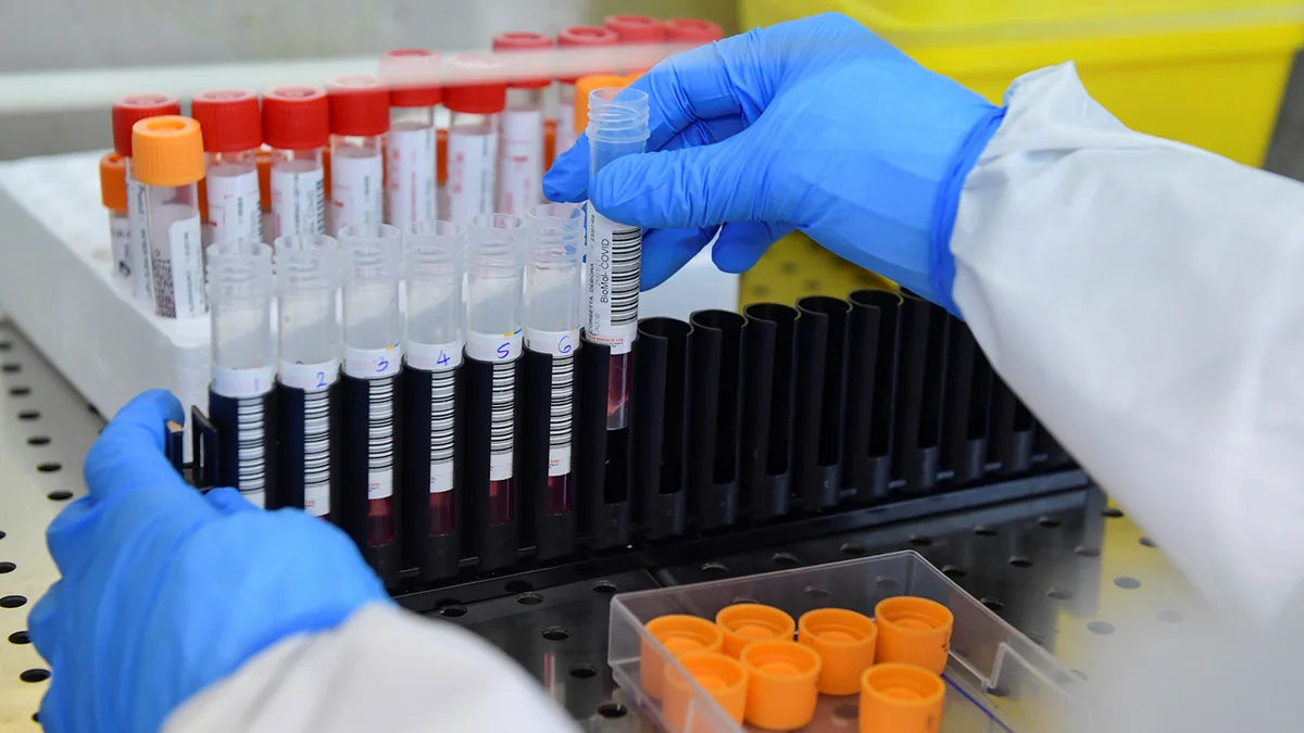 Russia reports two cases of South Africa coronavirus strain