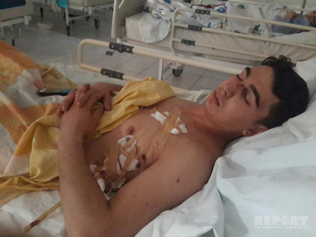 В Сумгайыте избили мужчину, ранившего ножом родственника - ОБНОВЛЕНО