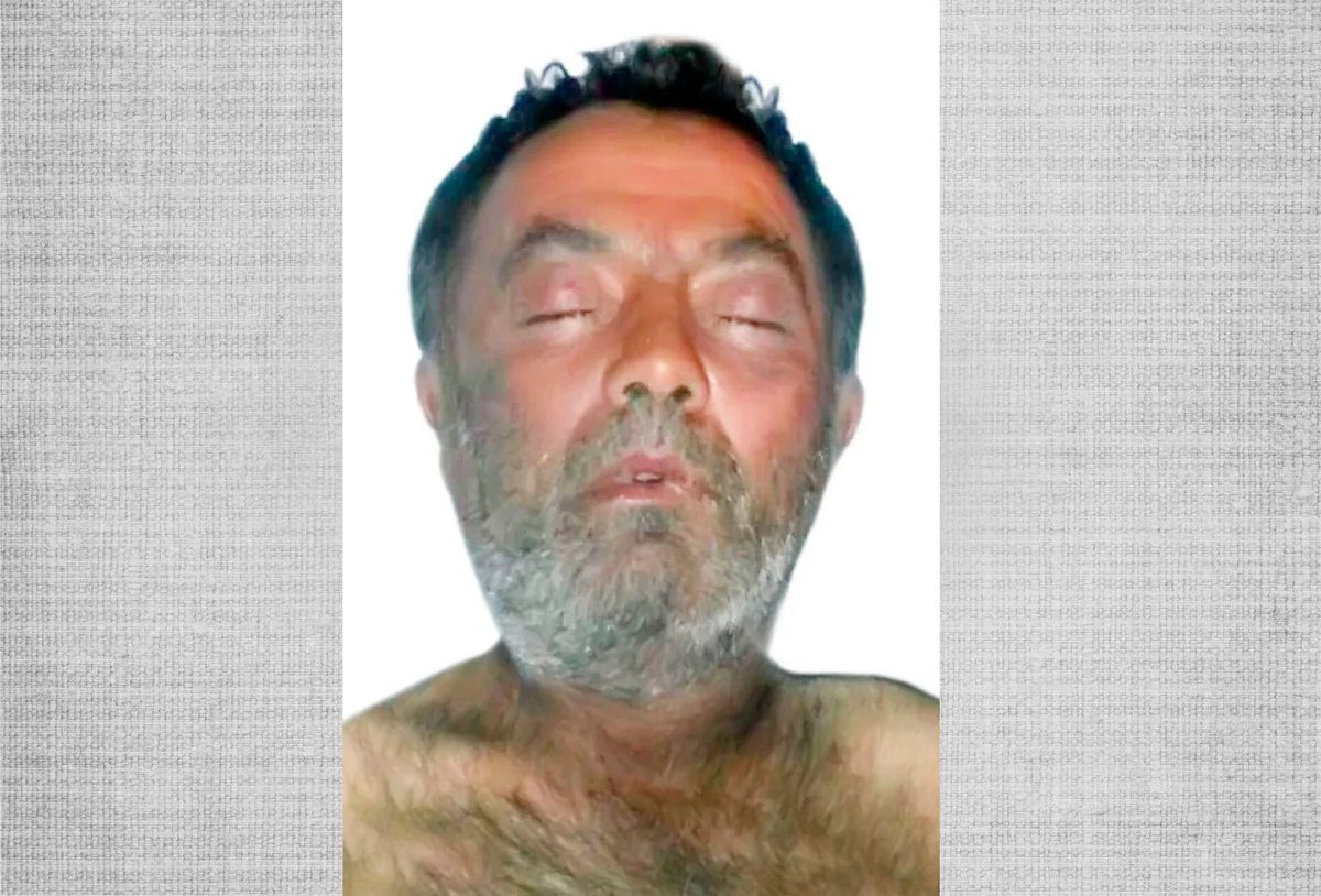 Bakı xəstəxanasında ölmüş kişinin şəxsiyyətini müəyyənləşdirmək mümkün olmayıb - FOTO