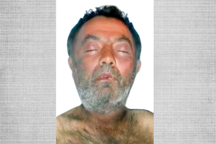 Bakı xəstəxanasında ölmüş kişinin şəxsiyyətini müəyyənləşdirmək mümkün olmayıb - FOTO