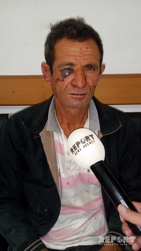 Şamaxıda kütləvi dava: Ər-arvad döyülüb - FOTO