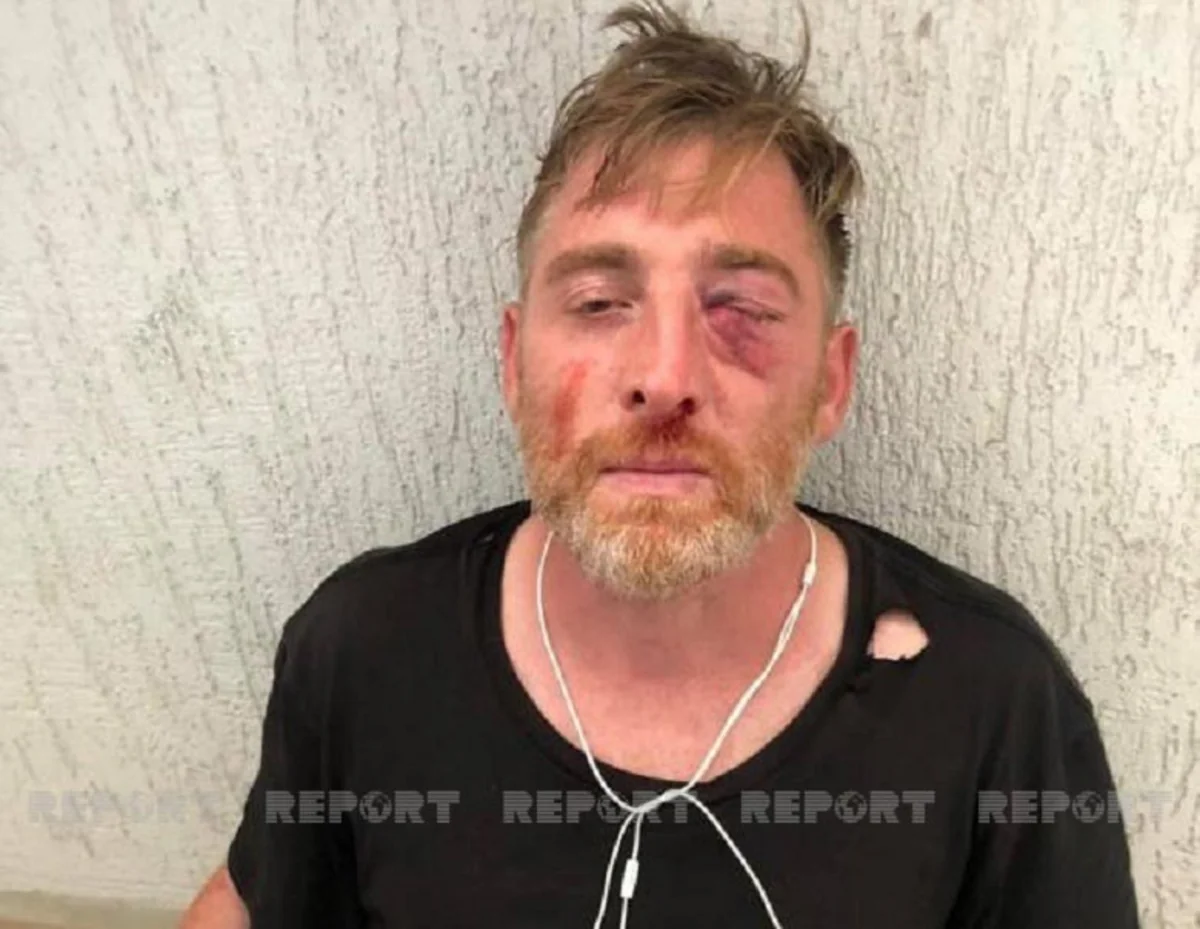 Скончался избитый в Тбилиси журналист