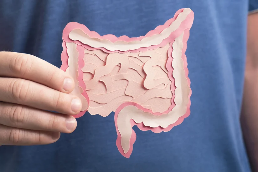 Bağırsaq xərçəngi riskini artıran xəstəliklər açıqlanıb