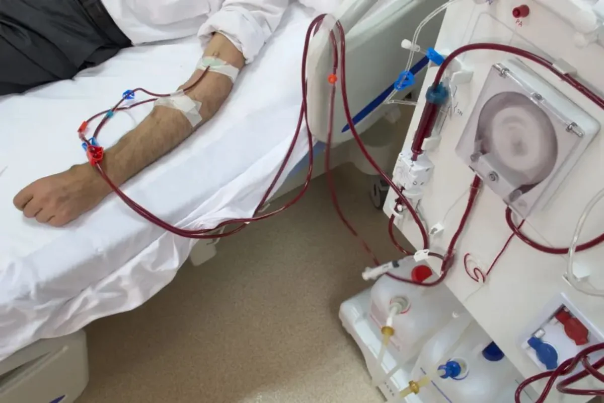 В прошлом году в рамках ОМС оказано более 1 480 первичных услуг гемодиализа