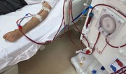 Ötən il icbari tibbi sığorta hesabına 1480-dən çox ilkin hemodializ xidməti göstərilib