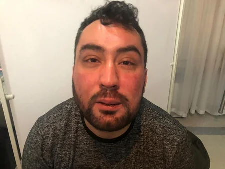 Bakıda bloggerə xəsarət yetirən şəxslər saxlanılıblar - FOTO