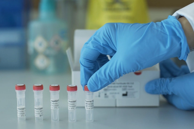 TƏBİB о ситуации с коронавирусом в Азербайджане - СТАТИСТИКА