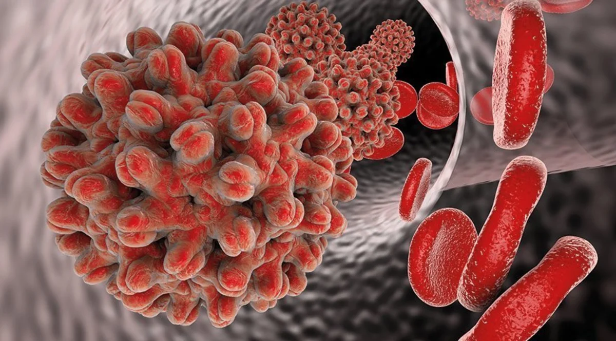 Son 5 ildə 10 mindən çox insanda viruslu hepatit aşkarlanıb