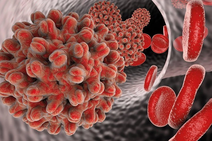 Son 5 ildə 10 mindən çox insanda viruslu hepatit aşkarlanıb