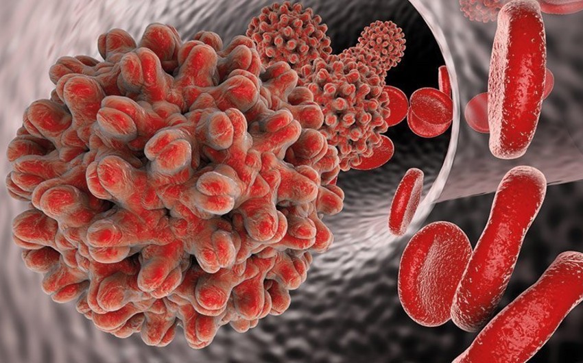Son 5 ildə 10 mindən çox insanda viruslu hepatit aşkarlanıb