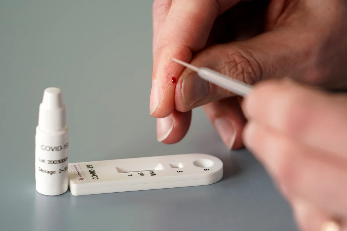 TƏBİB koronavirus testləri ilə bağlı məsələyə aydınlıq gətirdi - VİDEO