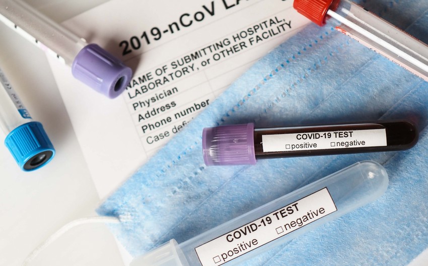 Azerbaijan reports 32 new COVID-19 cases