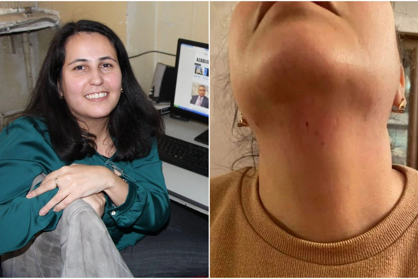 BŞBPİ-nin rəis müavini hücuma məruz qalmış jurnalistlə görüşüb