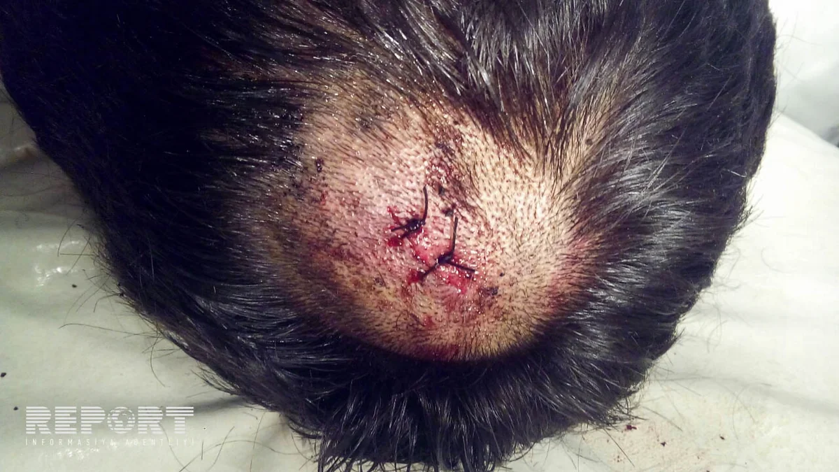 Şamaxıda 17 yaşlı gənc qayadan yıxılıb - FOTO