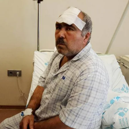 Baş direktor müavini: Xəstəxanada müalicə alan neftçilərdən ikisi bu gün evə buraxılacaq