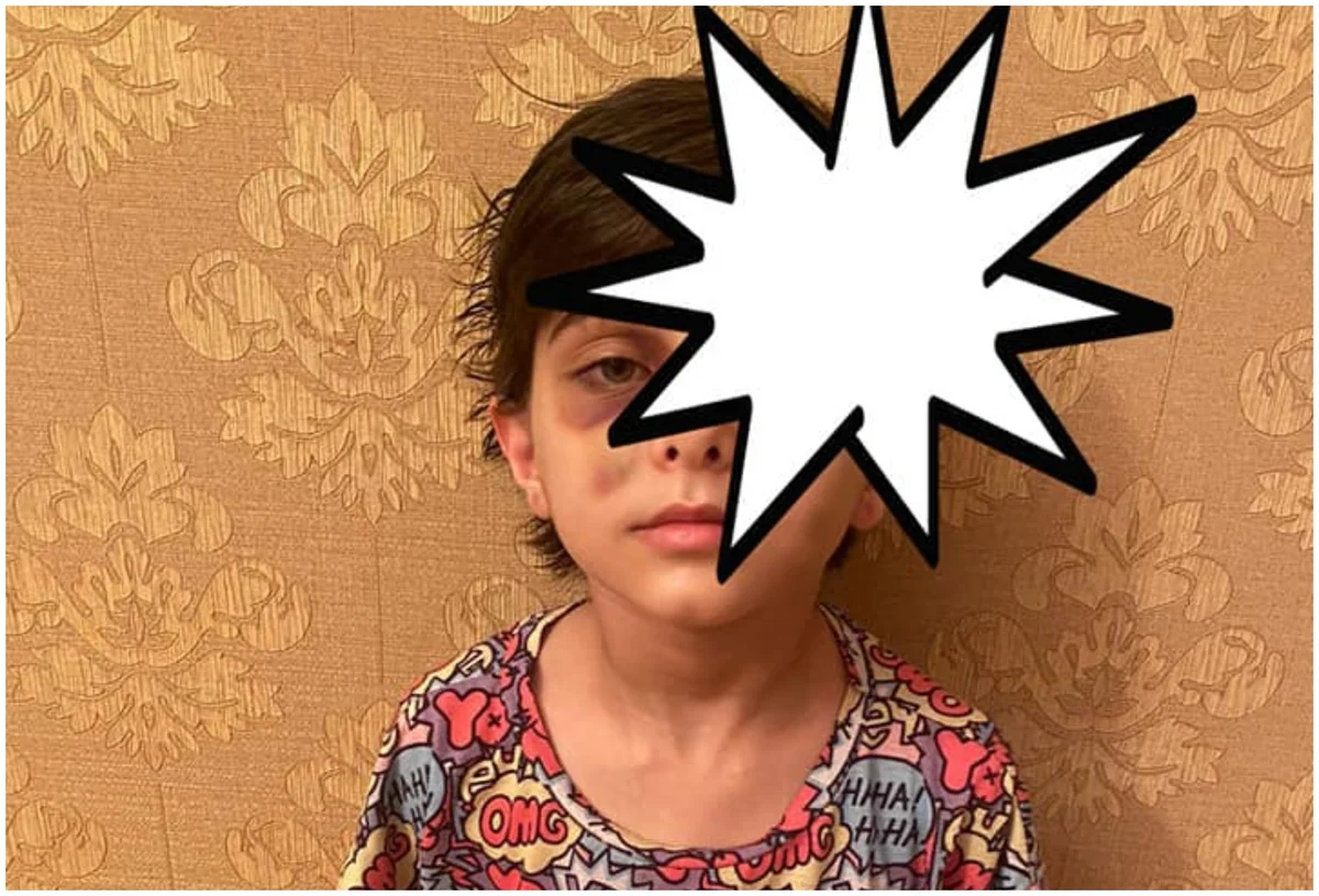 Sumqayıtda kişi sevgilisinin uşaqlarını döyərək xəsarət yetirib, istintaq başlayıb