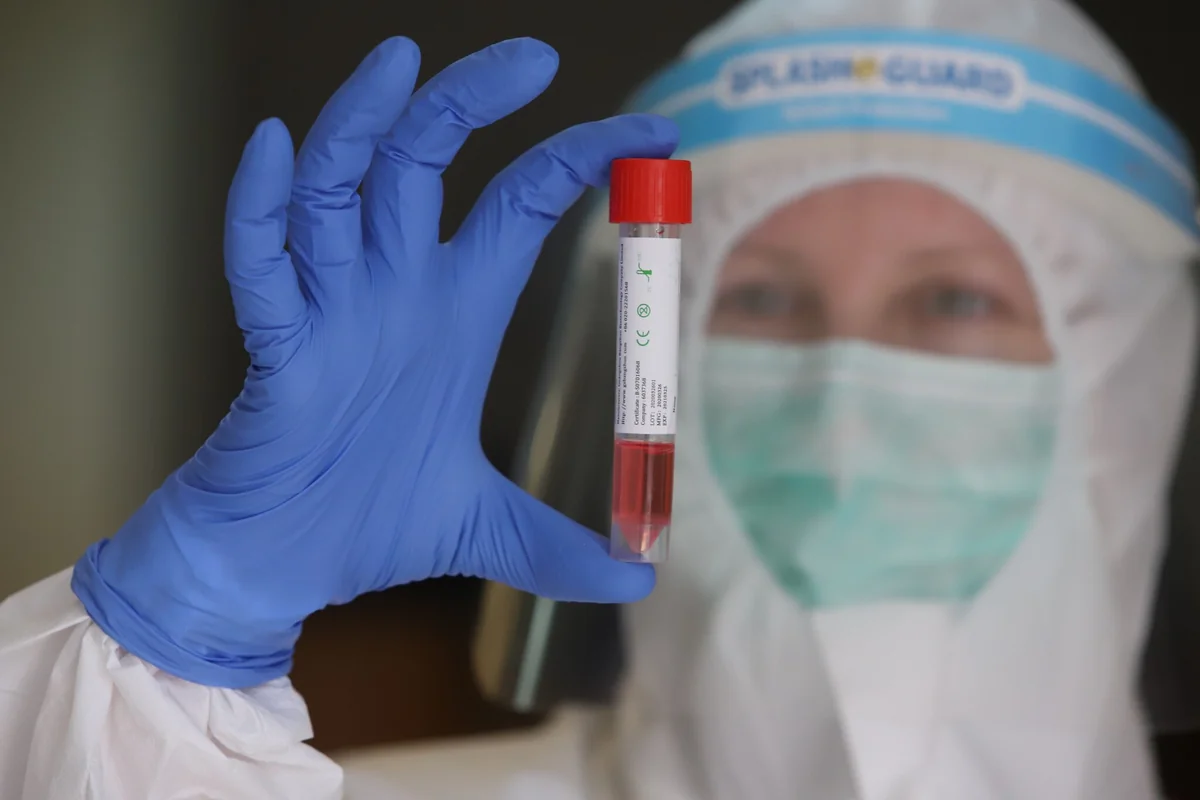 Coronavirus: Azerbaijan confirms 38 new cases, 42 recovered