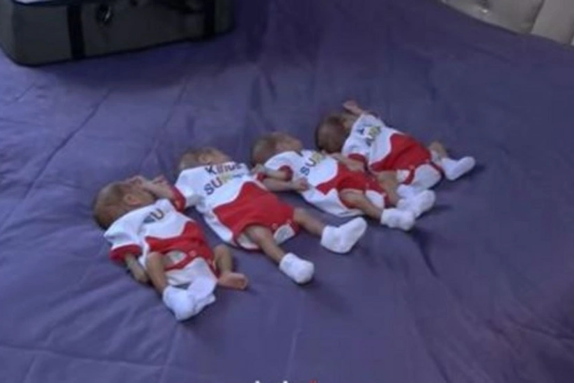 TƏBİB Bakıda doğulan beşəmlərin vəziyyəti ilə bağlı məlumat yayıb